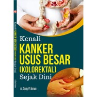 Kenali Kanker Usus Besar (Kolorektal) Sejak DIni