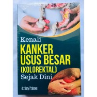 Kenali Kanker Usus Besar (Kolorektal) Sejak Dini